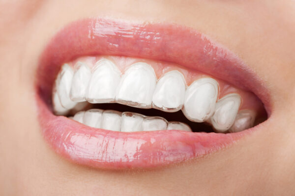 invisalign pamplona