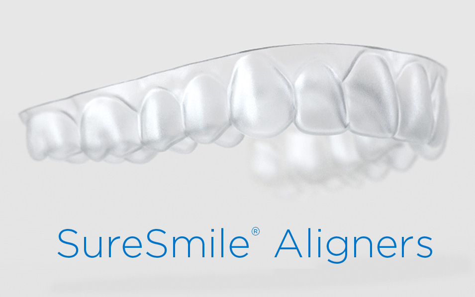 suresmile-aligners