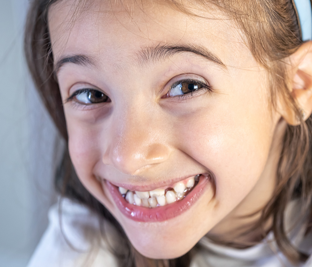 Ortodoncia para niños, dentista infantil